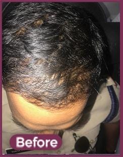 GFC Before